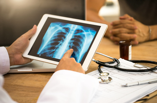 A doctor looks at x-rays on a tablet